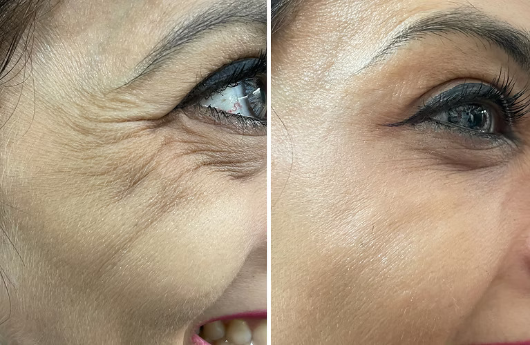 6c7cd2_8acb577e72f94bee93f7c206bedd906b~mv2