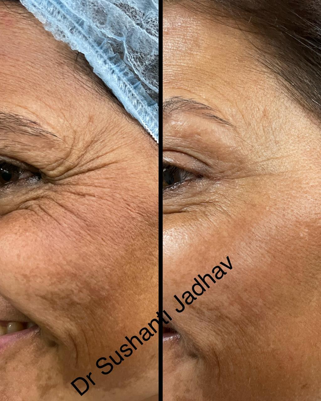 WhatsApp Image 2025-08-16 at 1.51.38 PM