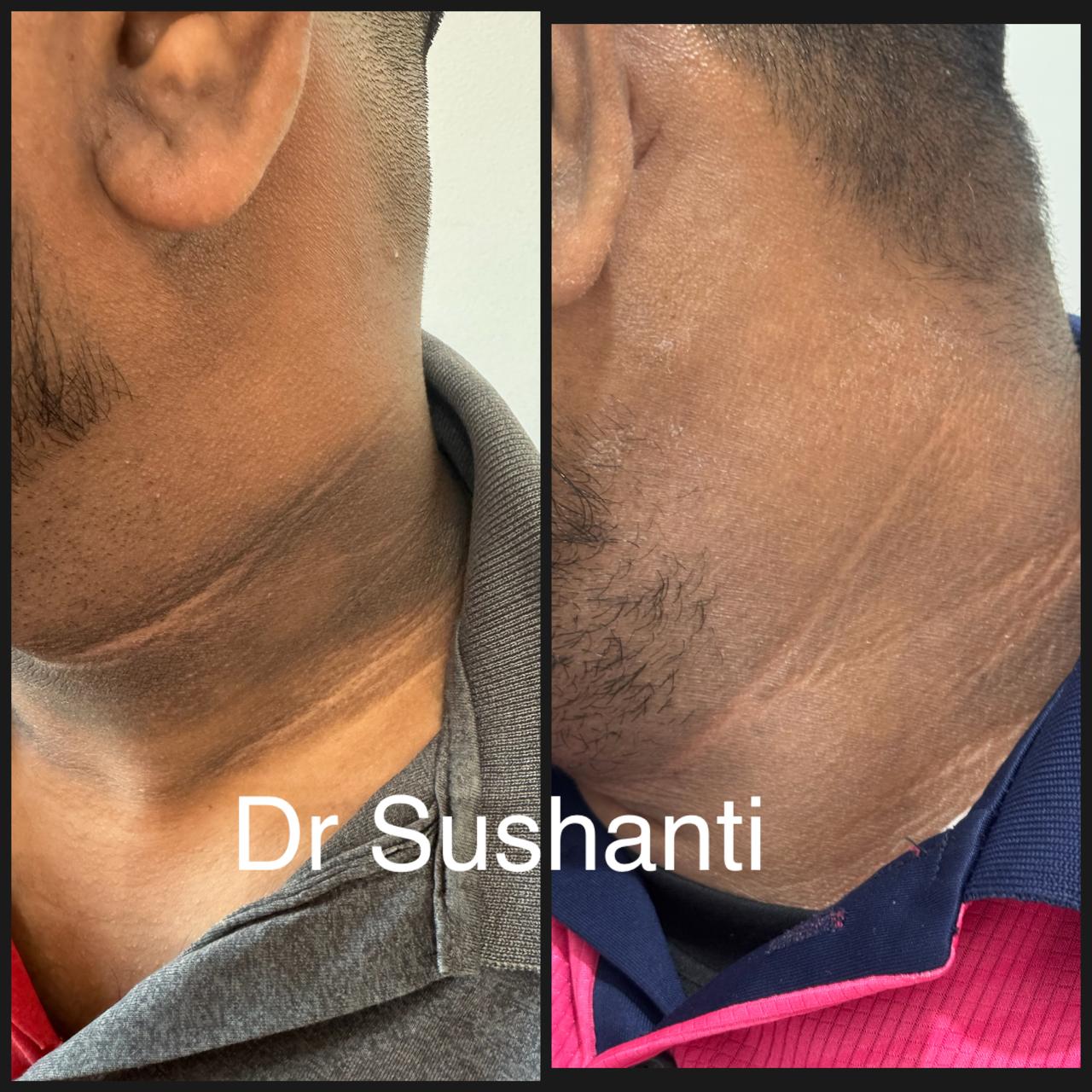 WhatsApp Image 2025-08-16 at 1.52.21 PM